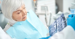 Dentist and elderly patient discussing dental implant treatment