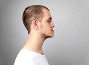 Side profile portrait of young man with an underbite