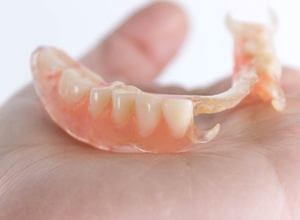 partial denture