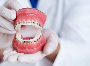 Gloved hands holding dental model with traditional metal braces