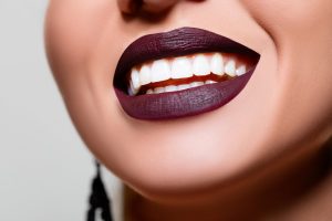 Close-up of beautiful smile after free teeth whitening treatment