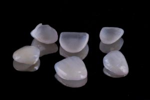 Dental veneers on dark, reflective surface